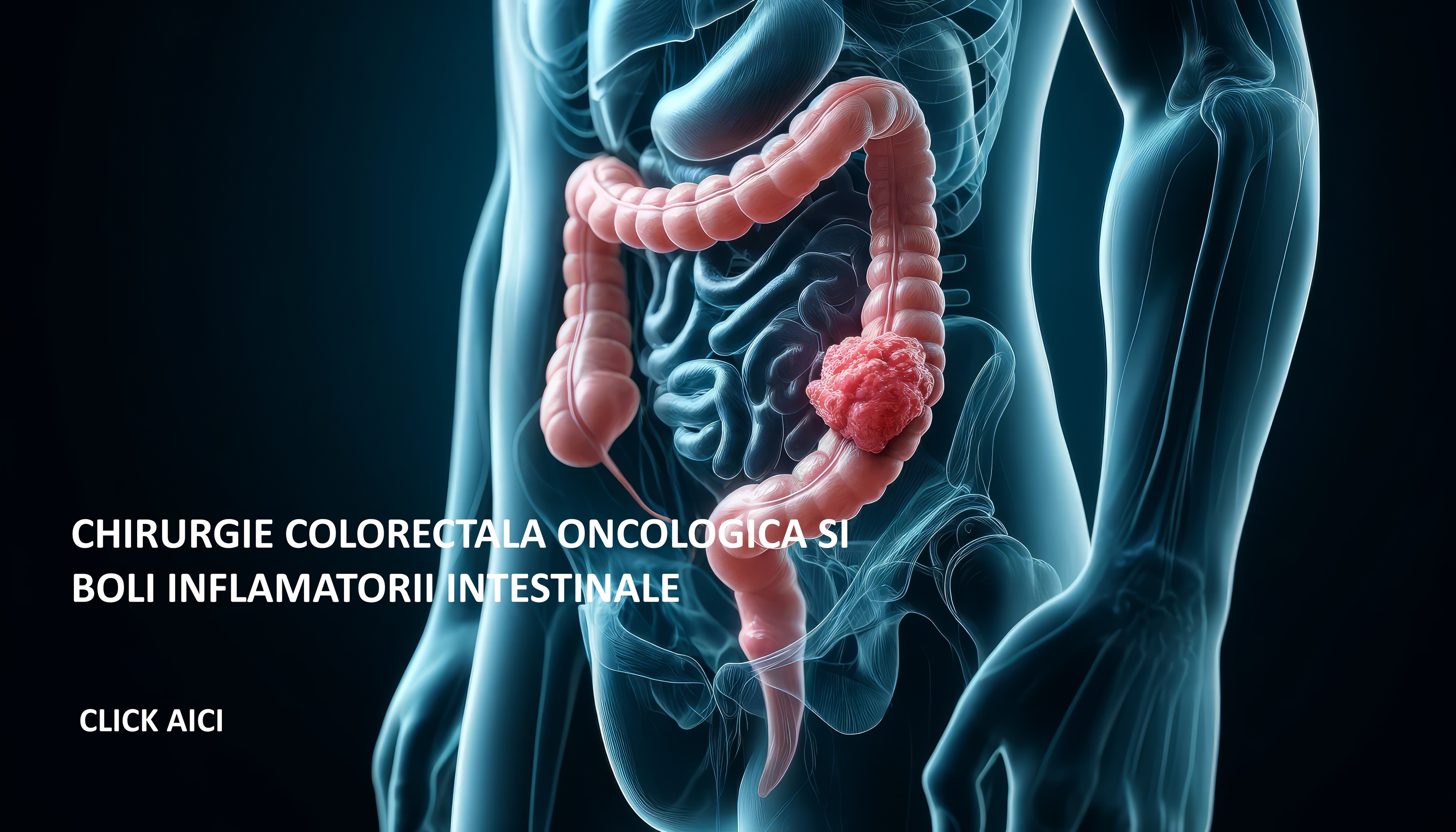 proceduri/servicii chirurgie colorectala si boili inflamatorii
